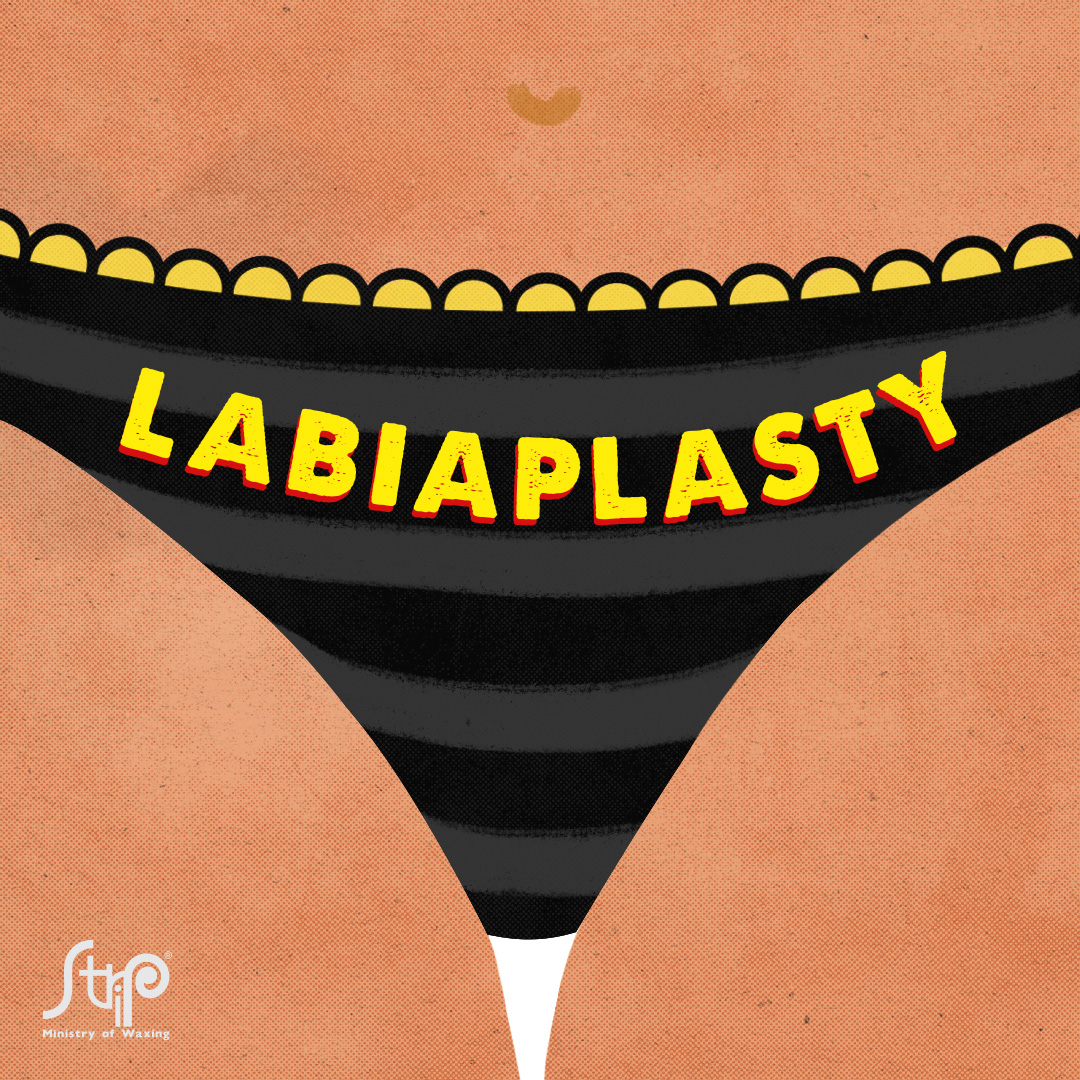 LABIAPLASTY