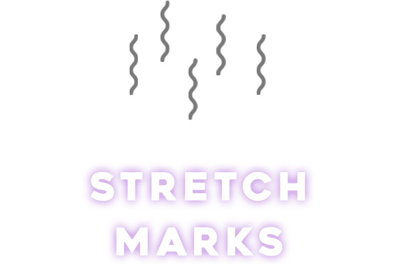 STRETCH MARKS