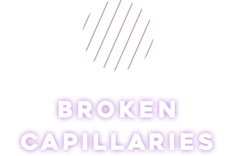 BROKEN CAPILLARIES